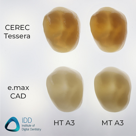 CEREC Tessera vs e.max CAD by Ivoclar Vivadent Institute of Digital Dentistry (2)