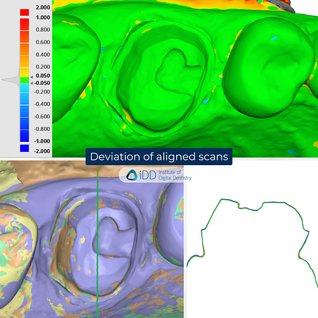 dentsply-sirona-primescan-2-3shape-trios-5-medit-i900-cerec-primescan-intraoral-scanner-comparison-idd-compares-institute-of-digital-dentistry-blog-deviation-of-aligned-scans