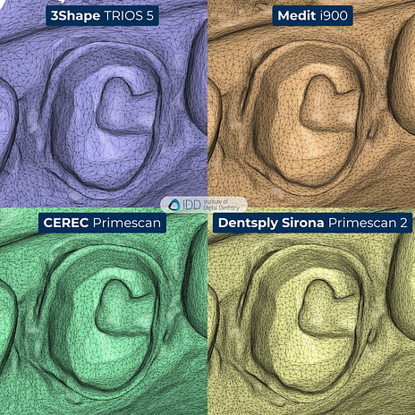 dentsply-sirona-primescan-2-3shape-trios-5-medit-i900-cerec-primescan-intraoral-scanner-comparison-idd-compares-institute-of-digital-dentistry-blog-mesh-density