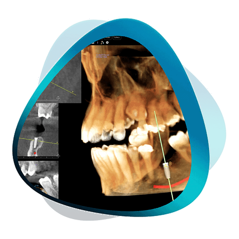 Dental Radiography