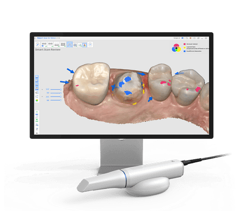 idd-compares-comparing-medit-i900-i700-wireless-vs-i700-vs-i600-vs-i500-scanners-idd-software
