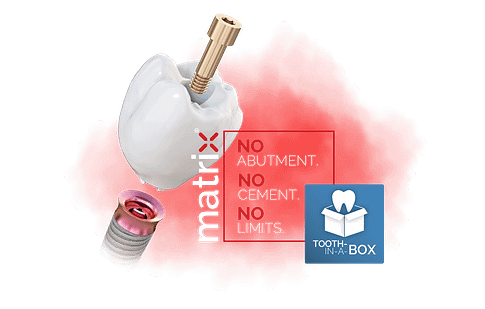 DDD-Podcast-S2E6-tri-dental-matrix-tooth-in-a-box-implants-idd-institute-of-digital-dentistry