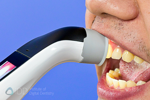 borea_cobra_shade_matching_dentistry_Dental Spectrophotometers and Shade-Matching_iDD18