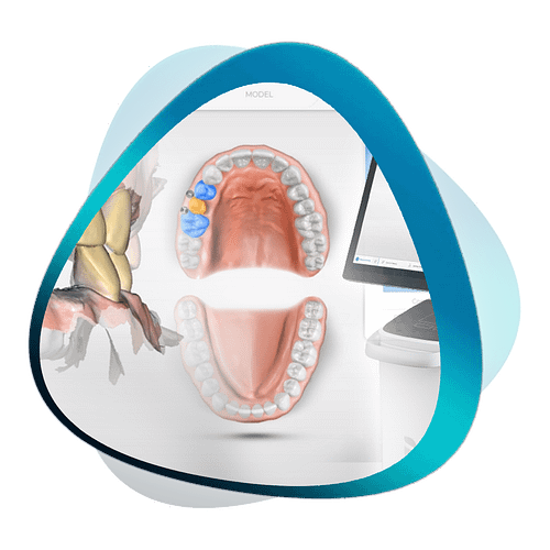 CEREC Masterclass-V2