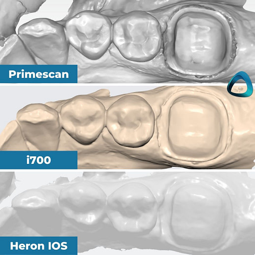 03-individual-monochrome-scans-in-their-native-software-idd-compares-intraoral-scanners-expensive-vs-cheap-compared-cerec-primescan-vs-medit-i700-vs-heron-ios