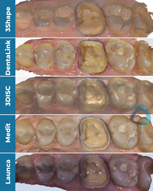 colour-scans-compare-cheap-intraoral-scanners-trios-4-launca-dl-206p-dentalink-s6000-3disc-heron-medit-i700