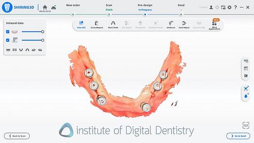 shining_3D_aoralscan_elite_review_institute_of_digital_dentistry8