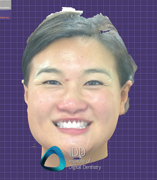 dental face scanners (3)