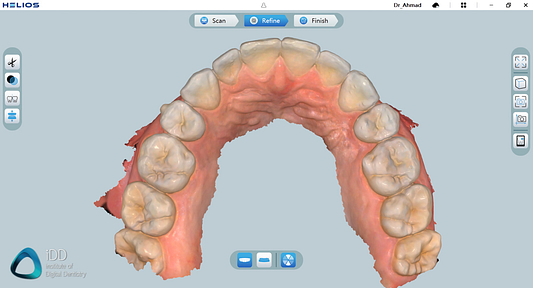 helios 600 intraoral scanner review software overview institute of digital dentistry (6)