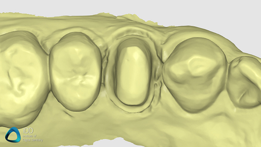 helios 600 medit i700 scans compare idd (4)