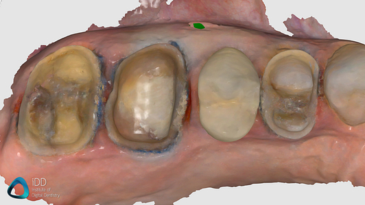 helios 600 institute of digital dentistry (2)