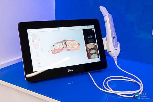 itero_element_5D_plus_intraoral_scanner_review_institute_of_digital_dentistry (11)