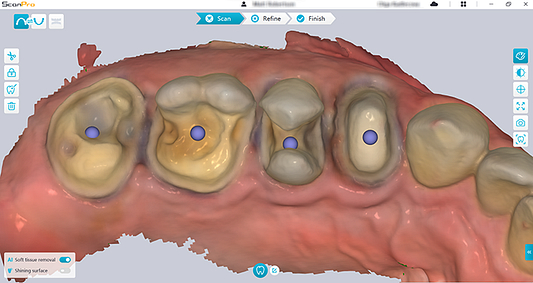 AS 200E MR preprocess color
