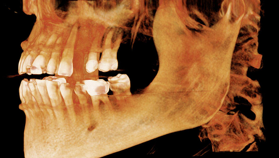 Byron Park 24 Implant 3Shape cbct 4