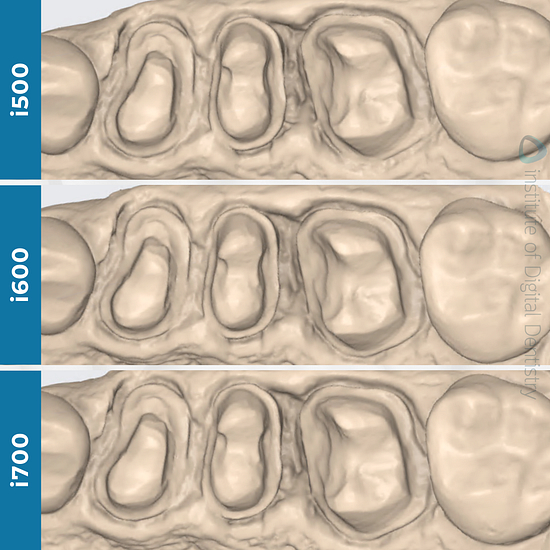 idd-compares-intraoral-scanner-medit-i500-i600-i700-native-processed-monochrome-scans