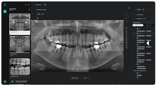 Eyes-of-ai-idd-blog-cephalometric-analysis-digital-dentistry-pathology-detection-before