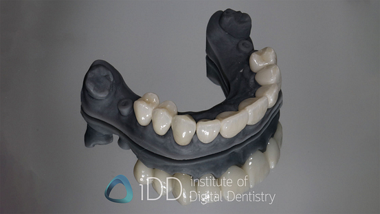 Fig-08-and-header-Peter-T-crowns-how-to-transition-into-digital-dentistry-workflows-watermarked