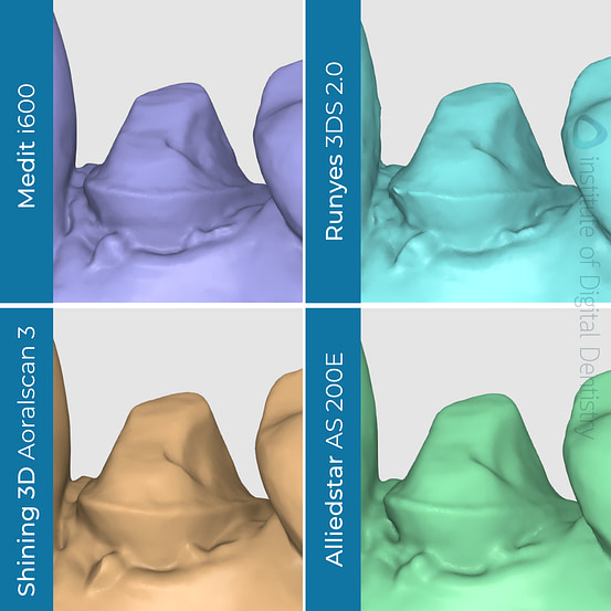 iDD-compares-margin-prep