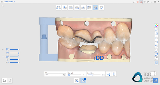 medit apps i600 i500 i700 i700 wireless medit design medit temporaries medit compare medit splints (6)