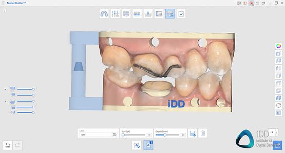 medit apps i600 i500 i700 i700 wireless medit design medit temporaries medit compare medit splints (6)