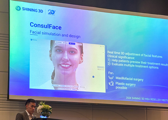 ConsulFace