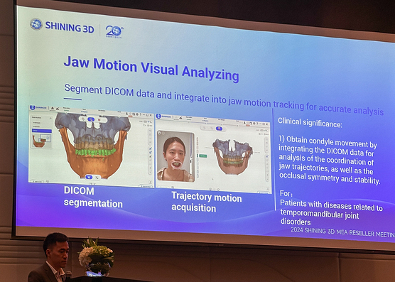 Jaw Motion Visual Analyzing