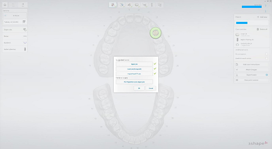 Create a New Case in Implant Studio 2