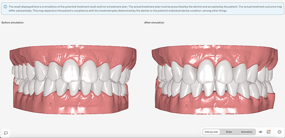 sure_smile_simulator2