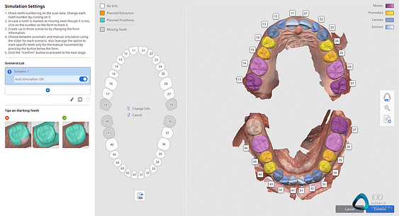 medit-link-software-orthodontic-simulator-model-base-creator-medit-i700-wireless-idd-institute-of-digital-dentistry-15