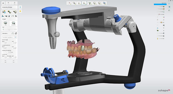 Dynamic Virtual Articulator