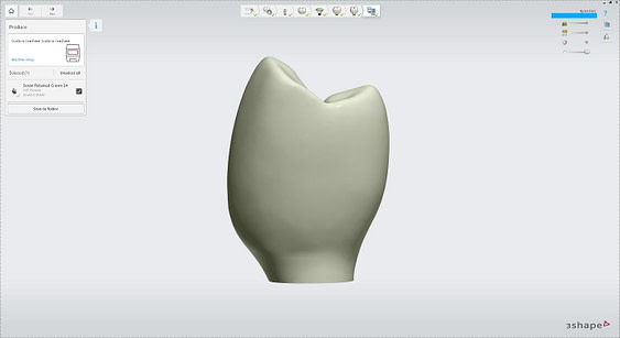 dental implant