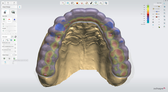3shape-intraoral-trios-scan-bite-splint-idd-institute-of-digital-dentistry-blog-byron-park-splint-studio-visualised-contacts