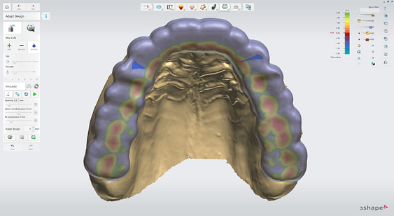 3shape-intraoral-trios-scan-bite-splint-idd-institute-of-digital-dentistry-blog-byron-park-splint-studio-final-occlusal-scheme