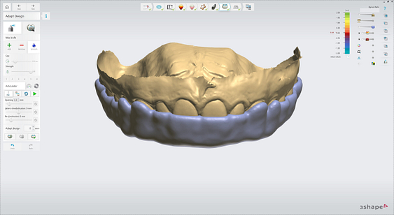 3shape-intraoral-trios-scan-bite-splint-idd-institute-of-digital-dentistry-blog-byron-park-splint-studio-final-smoothing