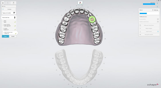 Create a New Case in Implant Studio