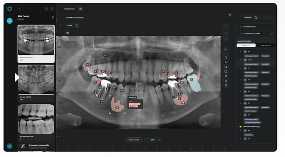Eyes-of-ai-idd-blog-cephalometric-analysis-digital-dentistry-pathology-detection-after