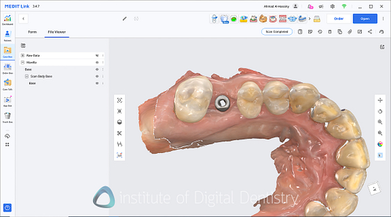 medit_i900_Classic_software_review4