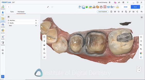 medit_i900_Classic_software_review9