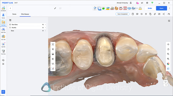 medit_i900_Classic_software_review5