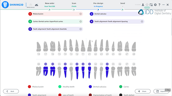 ConsulReport shining3D elite iDD
