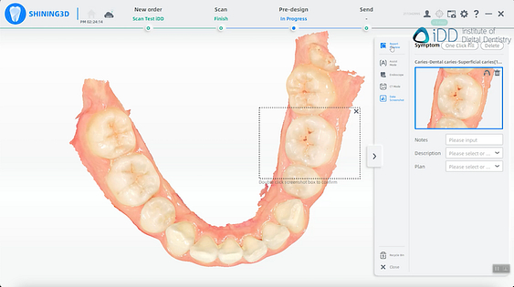ConsulReport shining3D elite