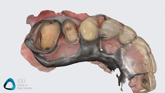 medit_i900_review_scanner_software_IDD (4)