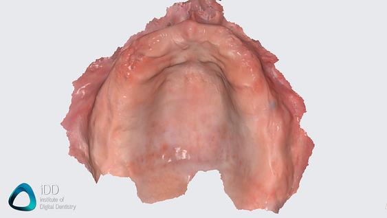 medit_i900_review_scanner_software_IDD (3)