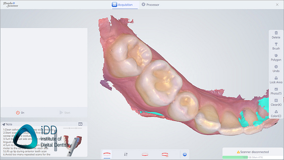 panda_smart_IOS_review_intraoral_scanner_institute_of_digital_dentistry (14)