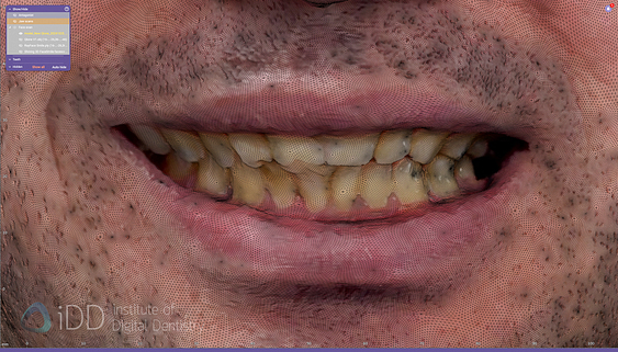 face_scanner_review_dentistry_iDD10