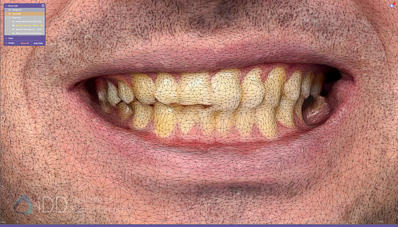 face_scanner_review_dentistry_iDD11