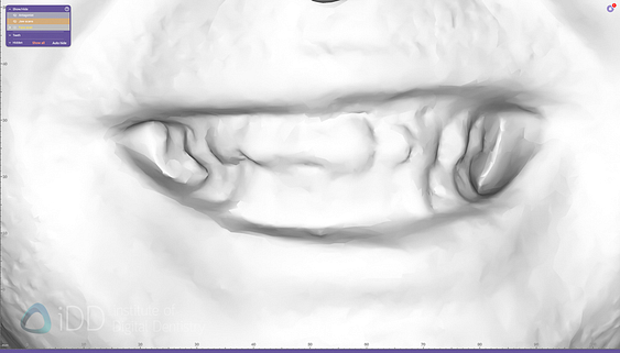 face_scanner_review_dentistry_iDD13
