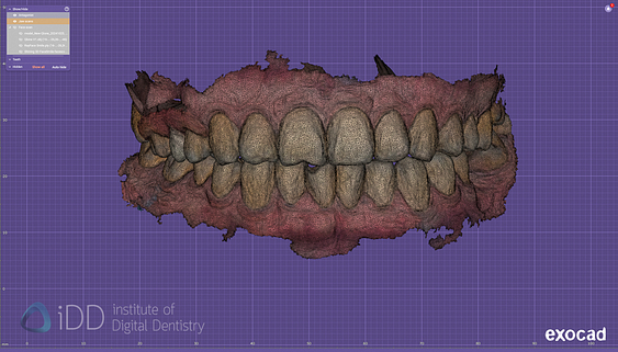 face_scanner_review_dentistry_iDD16
