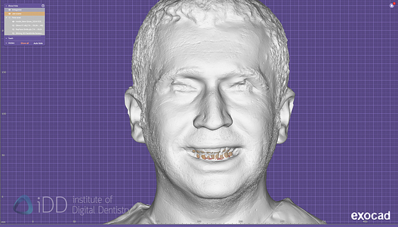 face_scanner_review_dentistry_iDD18