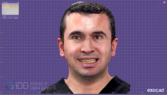 face_scanner_review_dentistry_iDD2